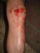 no pain no fun
 moshe pain
josh loberant